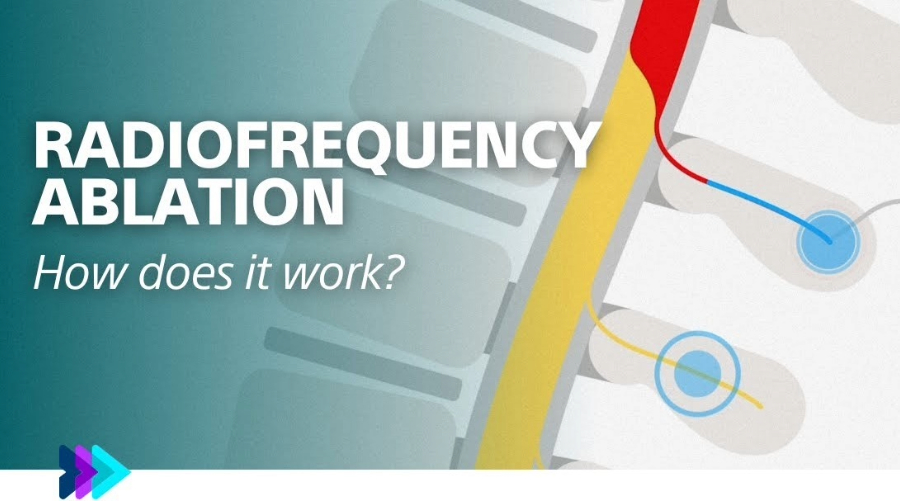 Questo video spiega l'RF e alcuni dei benefici che può offrire.